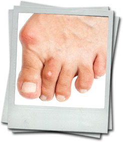 Diabetische & Reumatische voet
